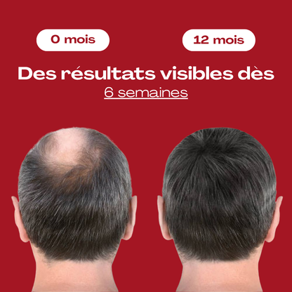 LuxCresce | Casque lumière rouge